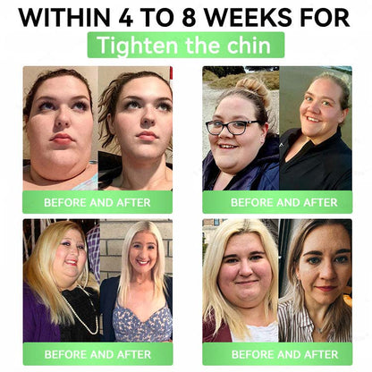 🌿Moringa × Berberine × AMPK 8-Benefit Slimming & Metabolic Nano Microneedle Patch