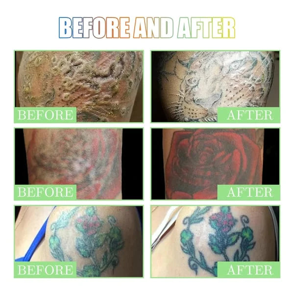 ⏰Hot Sale 49% OFF🔥Tattoo Brightening Aftercare Cream