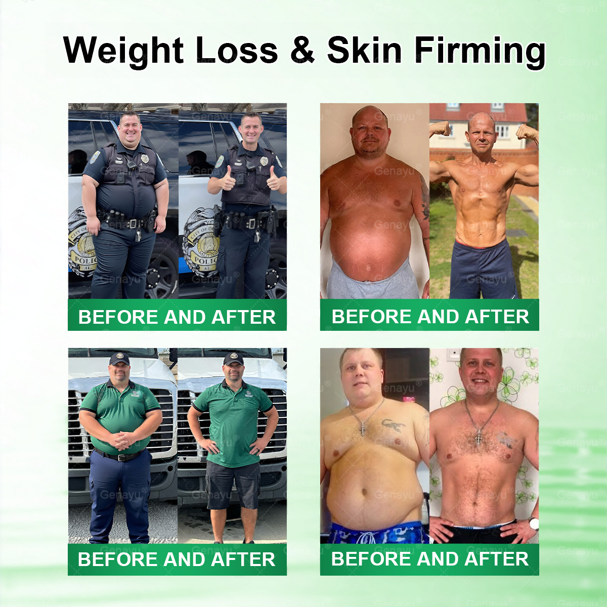 🌿Moringa × Berberine × AMPK 8-Benefit Slimming & Metabolic Nano Microneedle Patch