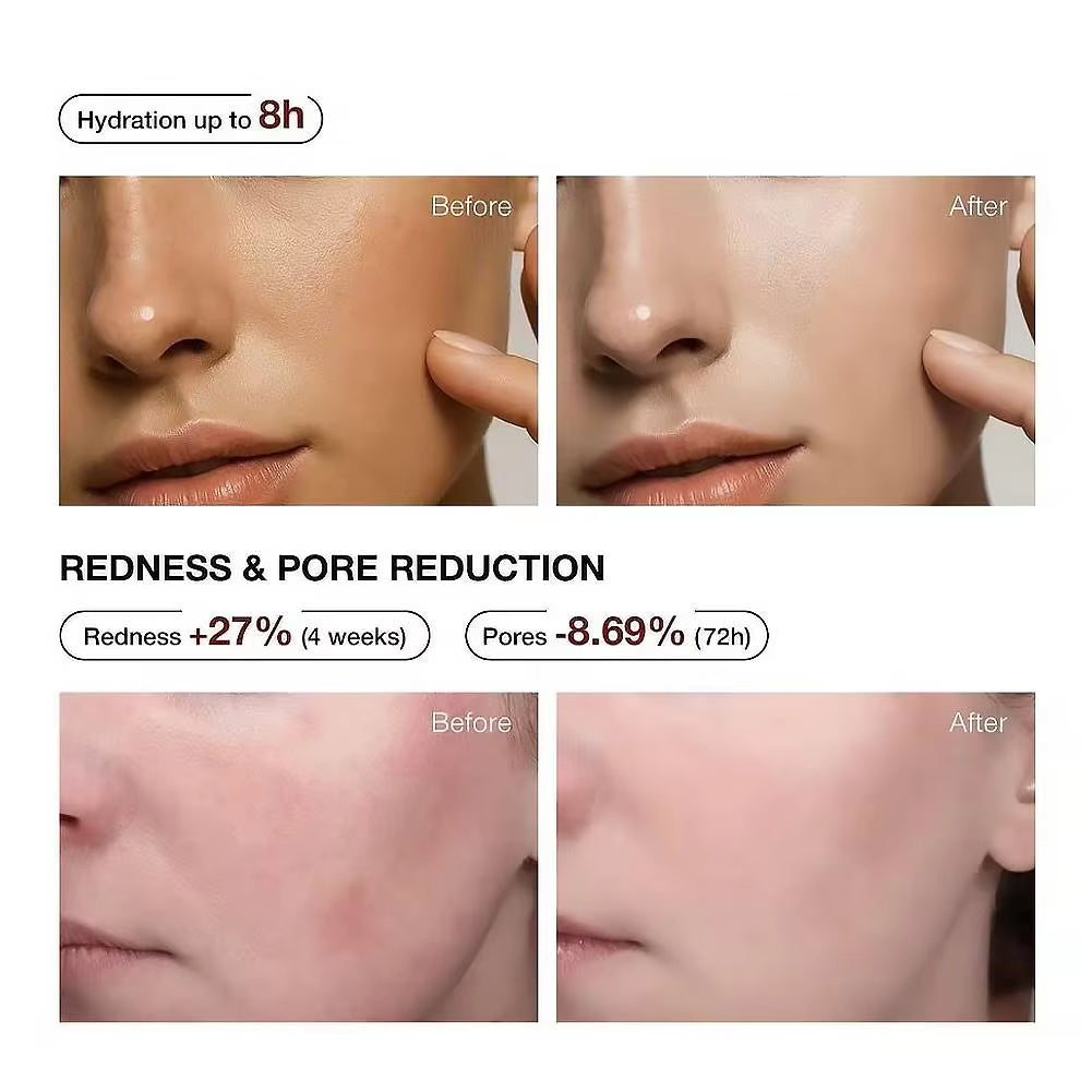 Teashell 5% Niacinamide + Alpha Arbutin Dark Spot Serum