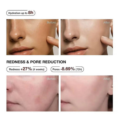 Teashell 5% Niacinamide + Alpha Arbutin Dark Spot Serum