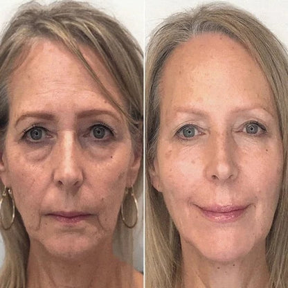 Vcoxno™ Eye Pods Get Real Results (49% discount & free shipping)