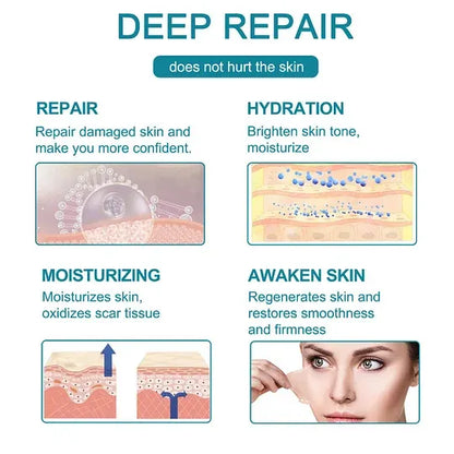 Advanced Scar Spray For All Types of Scars - For example Acne Scars, Surgical Scars and Stretch Marks ⚡️⚡️⚡️