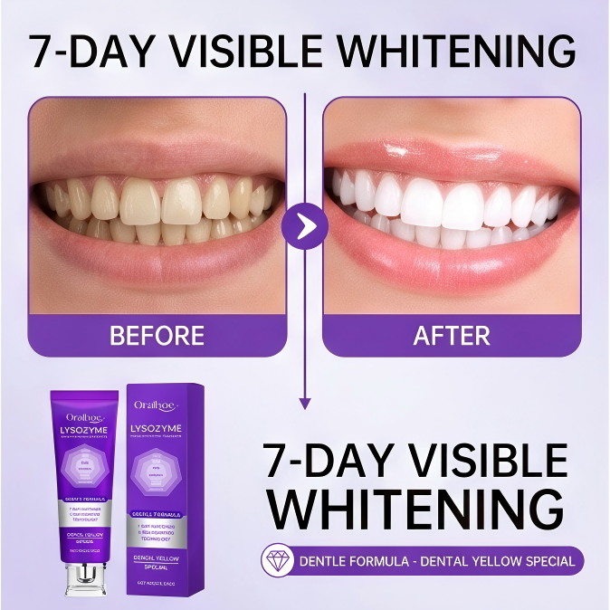 🔥 Vcoxno™ Whitening Toothpaste — YELLOW TEETH ARE SNITCHING ON YOU