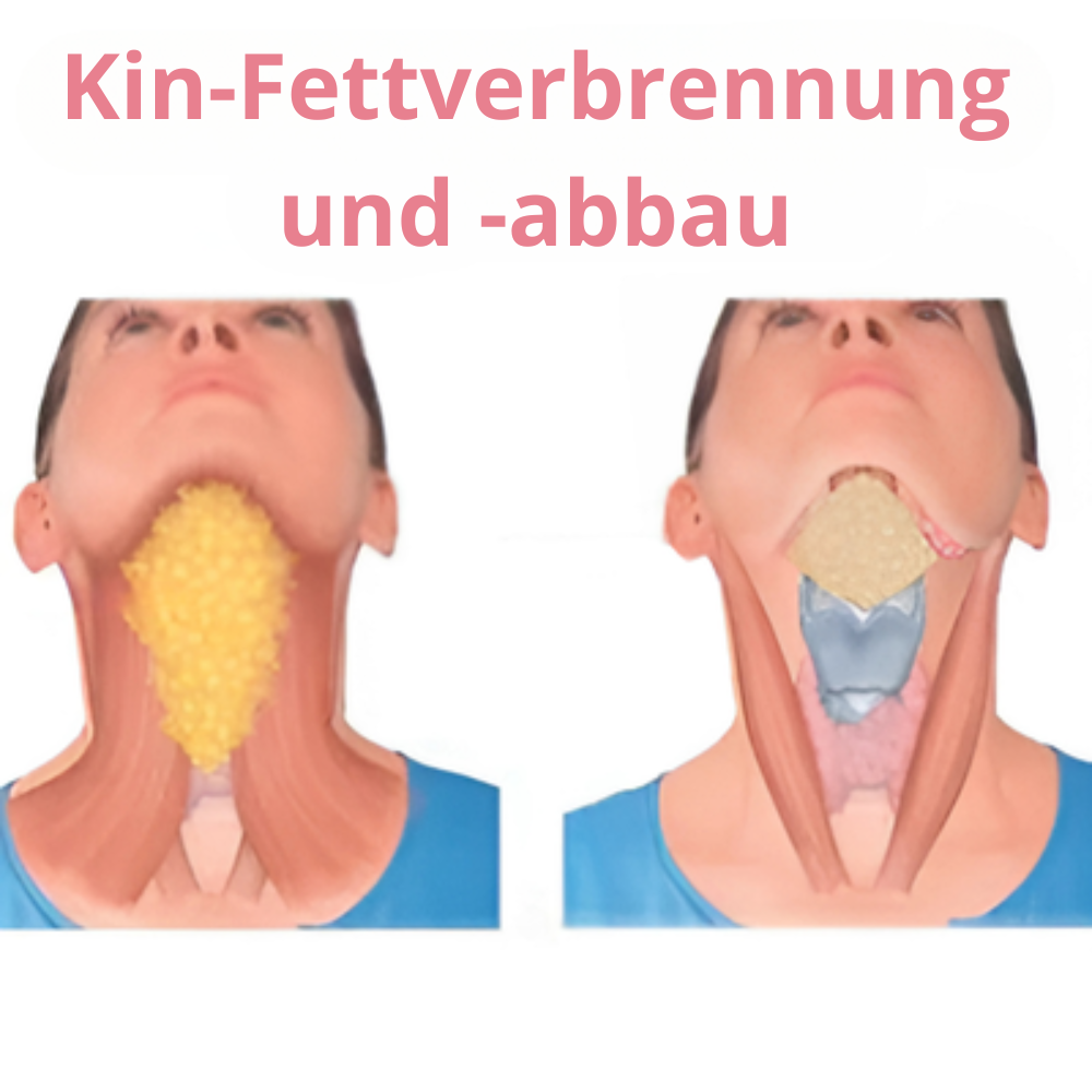 Vcoxno™ Say Goodbye to Your Double Chin (Buy 3 Get 2 Free)