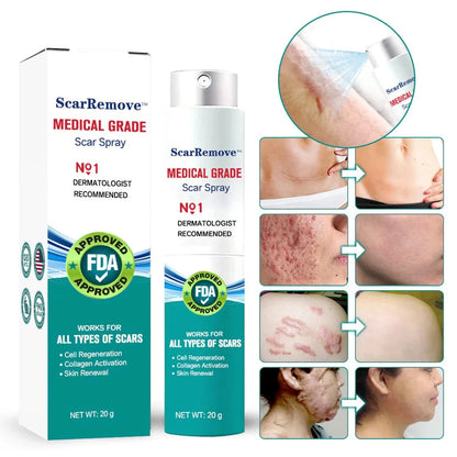 Advanced Scar Spray For All Types of Scars - For example Acne Scars, Surgical Scars and Stretch Marks ⚡️⚡️⚡️